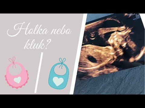 Video: Kolik Bych Měl Zvážit Podle Pohlaví A Výšky?