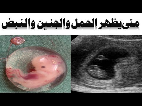 متى يظهر الحمل في السونار | متى يظهر الجنين | متى يظهر نبض الجنين