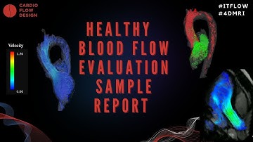 iTFlow: Blood Flow Evaluation Sample Report