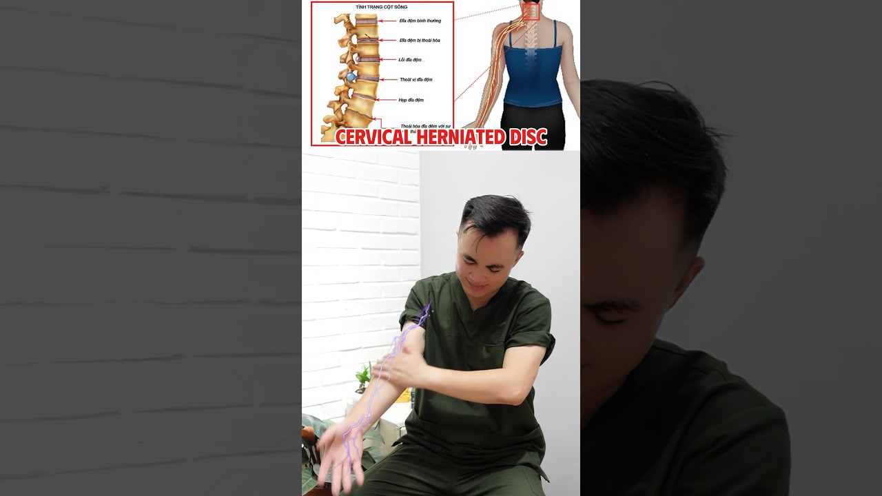 Relieve Nerve Pain 💥💯❤️ 