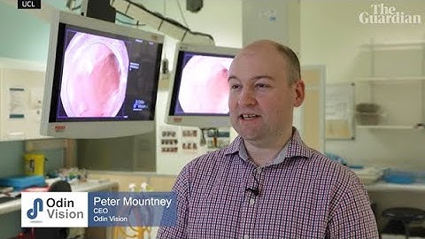 CADU – AI for gastroenterology featured in The Guardian