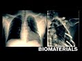 Innovative Biomaterials and Their Role in Healing and Recovery
