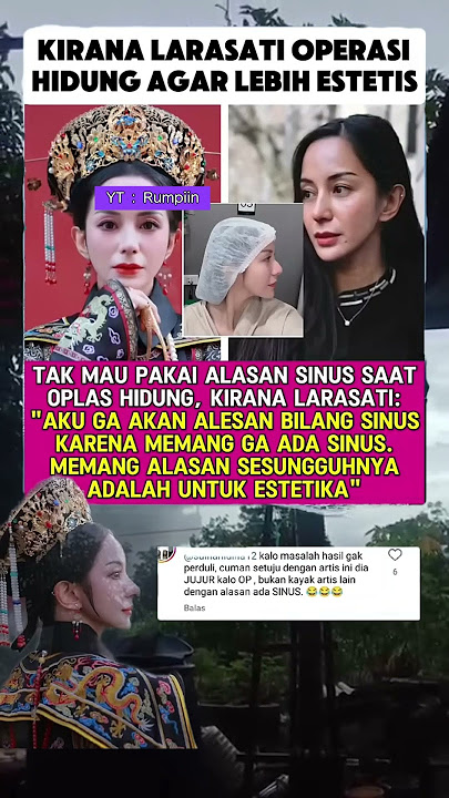 Kirana Larasati Oplas Hidung