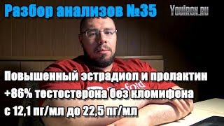 ПОВЫШЕНИЕ ТЕСТОСТЕРОНА НА 86% | ТЕРАПИЯ ПРИ ПОВЫШЕННОМ ПРОЛАКТИНЕ И ЭСТРАДИОЛЕ ПОВЫШЕНИЕ ТЕСТОСТЕРОНА НА 86% | ТЕРАПИЯ ПРИ ПОВЫШЕННОМ ПРОЛАКТИНЕ И ЭСТРАДИОЛЕ