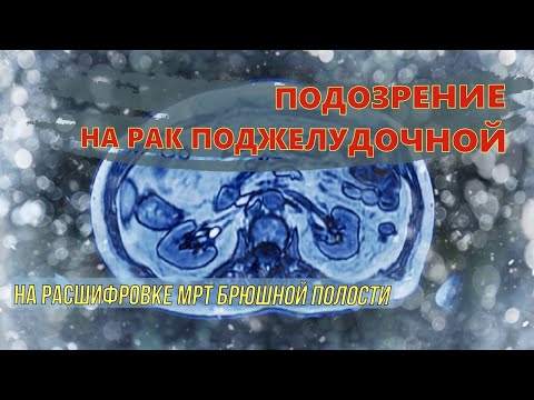 Video: Рентгенологиялык технолог рентгенолог боло алабы?