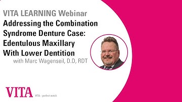 Addressing the Combination Syndrome Denture Case: Edentulous Maxillary With Lower Dentition