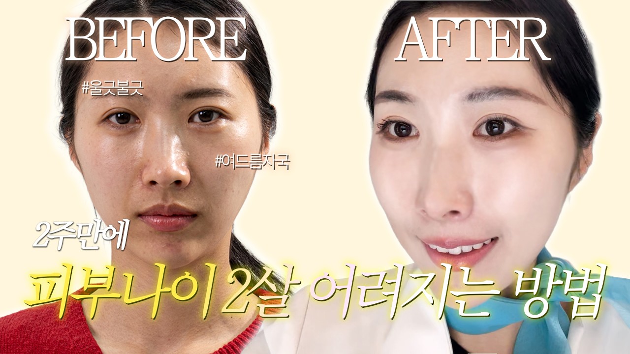 #쇼호스트가 14일 동안 매일 #물방울초음파 받으면?