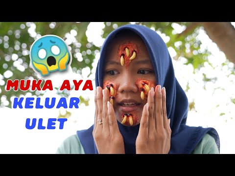 GELI MUKA AYA KELUAR ULET BELATUNG | CHIKAKU FAMILY