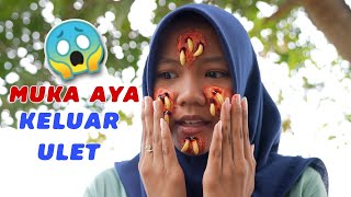 GELI MUKA AYA KELUAR ULET BELATUNG | CHIKAKU FAMILY