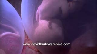 Twins before Birth by David Barlow 124,320 views 9 years ago 41 seconds