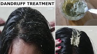 This home remedy will help to remove dandruff and you can see results
in 1 day itself. free clean scalp ultimately lead fast hair growth...