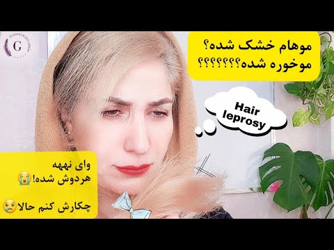 راههای درمان موخوره و موهای خشک آموزش رایگان 