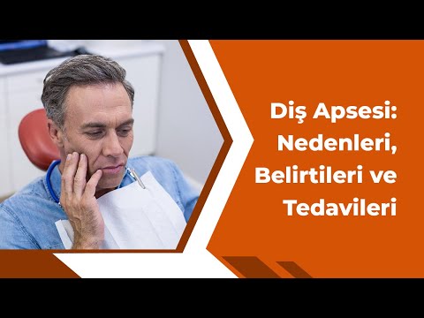 Diş Apsesi: Nedenleri, Belirtileri ve Tedavileri...