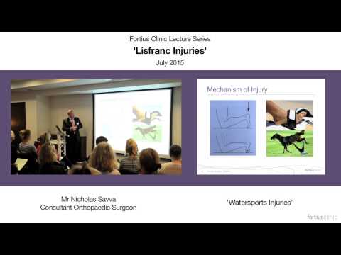Watersports - Lisfranc