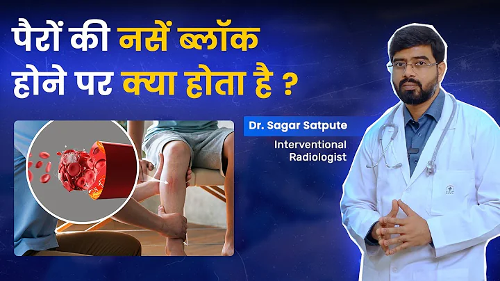 Leg Pain, Coldness & Swelling? | Acute Lower Limb Ischemia Explained by Dr. Sagar Satpute.