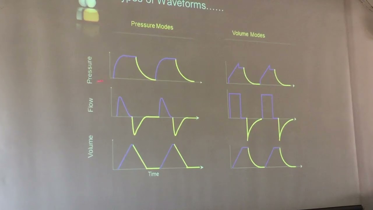 Ventilator Graphics Prof Sherif Elanwary