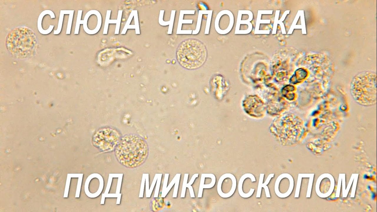 Человеческая слюна. Слюни под микроскопом. Человеческая слюна под микроскопом. Бактерии в слюне человека под микроскопом. Микроскопия слюны.