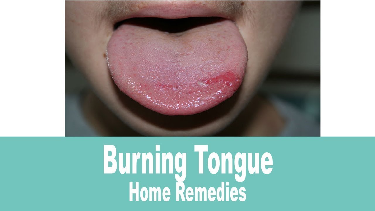 How to Cool Your Tongue After Eating Spicy Food How to Cool Your Tongue After Eating Spicy Food new foto How to Cool Your Tongue After Eating Spicy Food How to Cool Your Tongue After Eating Spicy Food new pics