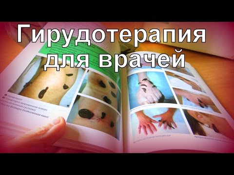 КНИГИ ПО ГИРУДОТЕРАПИИ ЧАСТЬ 1 Руководство по гирудотерапии. Самый лучший учебник. ЛИЧИНКОТЕРАПИЯ