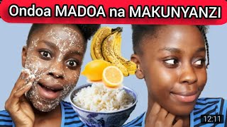 SCRUB ya kutoa MADOA na MAKUNYANZI usoni kwa siku chache tu. | ft Bariki Karoli