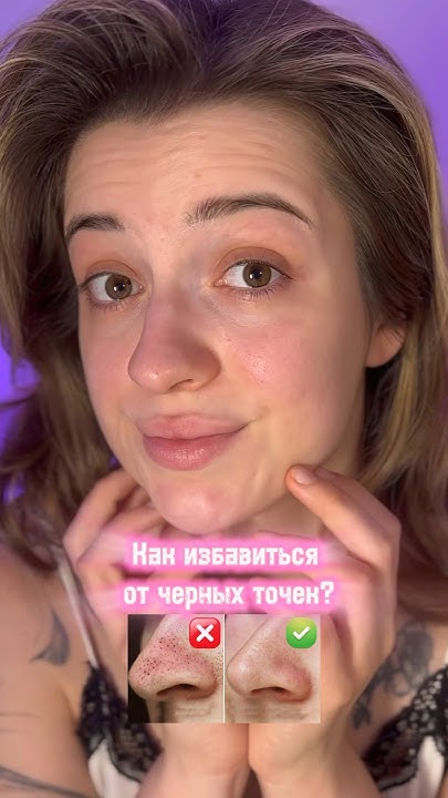 Черные точки или сальные нити? Гель тоже брала на озоне: 821331533 # ...