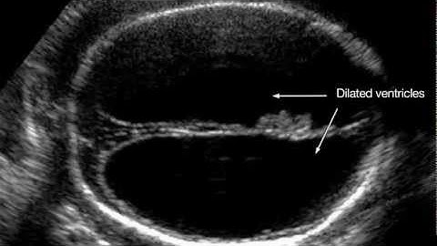 Ultrasound Training: Assessment of Fetal Growth and High-Risk Pregnancies