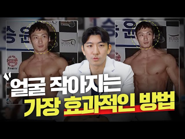 레전드 얼굴소멸 수술&시술 TOP3