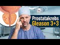 Prostatakrebs: Sofort OP? Nicht jeder Prostatakrebs braucht eine direkte Behandlung!