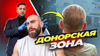 ИДЕАЛЬНАЯ ДОНОРСКАЯ ЗОНА, КАКАЯ ОНА?