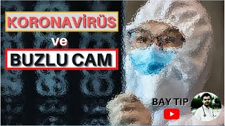 Buzlu Cam Görünümü Nedi̇r?