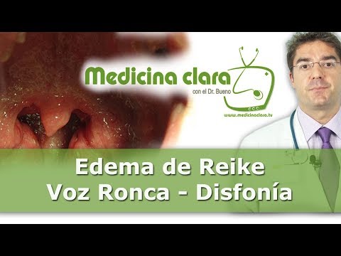 Vídeo: Laringe: Estructura, Tratamiento, Edema