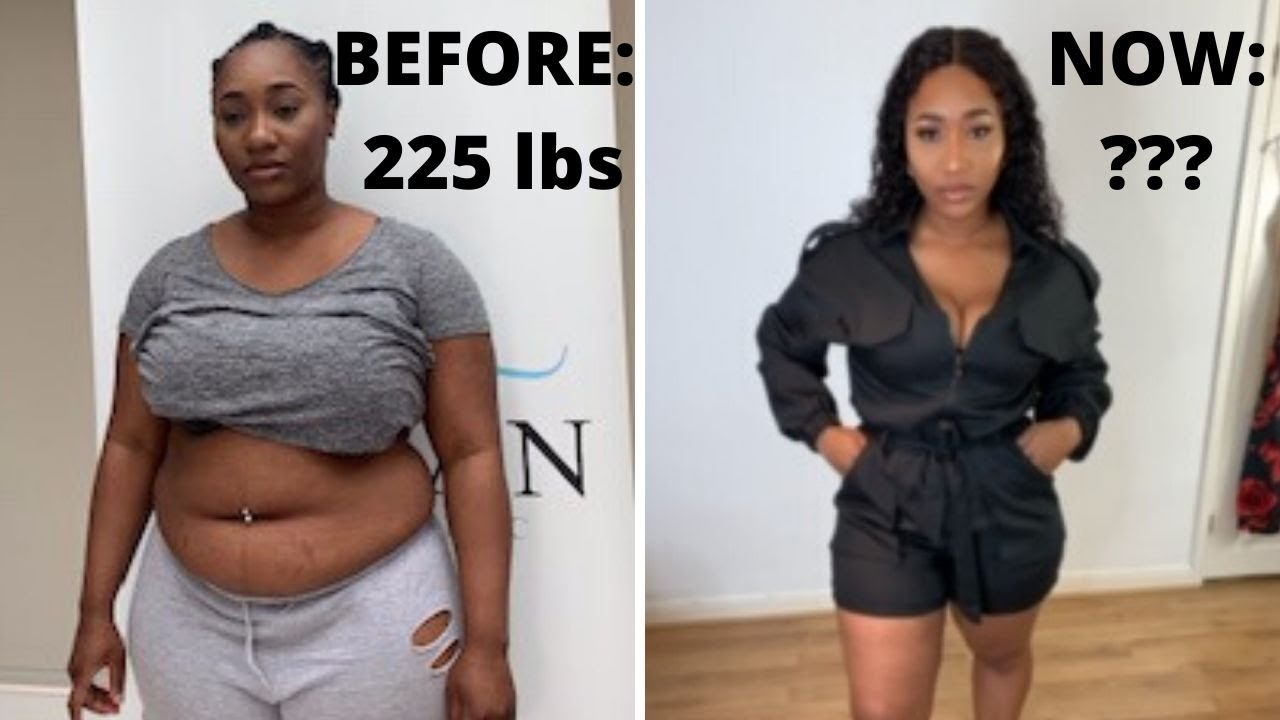 gastric bypass before and after black women