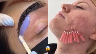 Most Extreme Beauty Treatments 2022 Best Smart and Helpful Beauty Hacks | Virtual Beauty