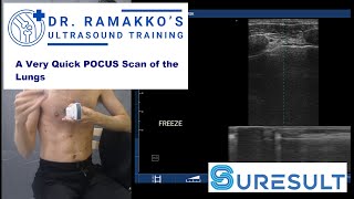 Suresult Ultrasound Quick POCUS Lung Exam – 11% Off with Code “POCUS11”
