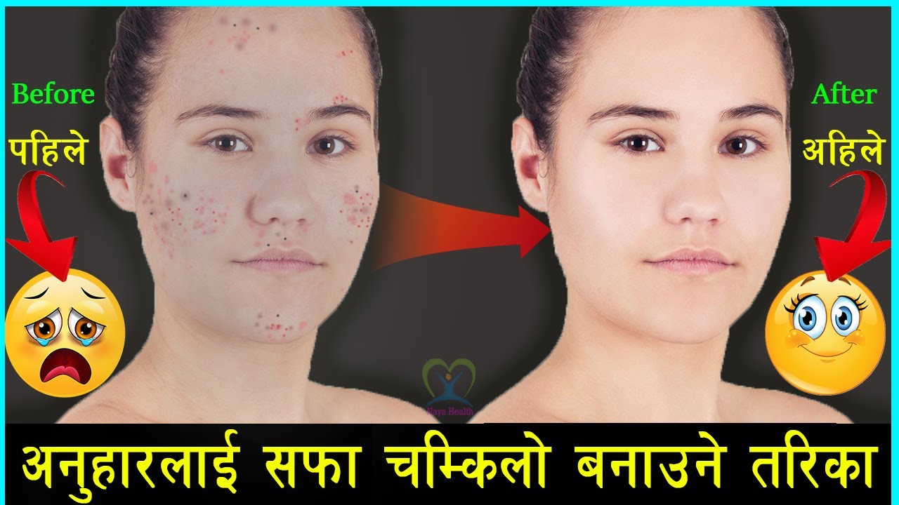 6 Face Cleaning Tips In Nepali Healthy Face 6 Face Cleaning Tips In Nepali Healthy Face