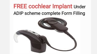 Free cochlear implant under Adip Scheme, Form filling
