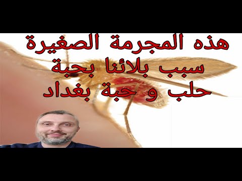ماهي حبة حلب أو حبة بغداد و من المسؤول عنهم
