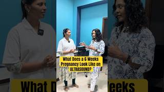 What Does A 6 Weeks Pregnancy Look Like On Ultrasound?