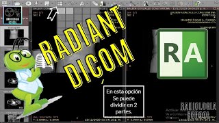 ✅Tutorial de funcionamiento RADIANT DICOM visualizador de imágenes medicas (RADIOGRAFIAS) screenshot 4