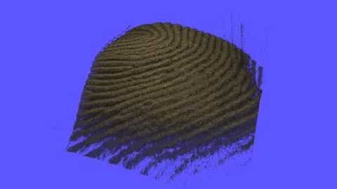 High definition live 4D-OCT in vivo for surgical guidance