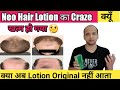 Why Neo Hair Lotion Trends Is Low🤔क्या आजकल असली Lotion नहीं आता