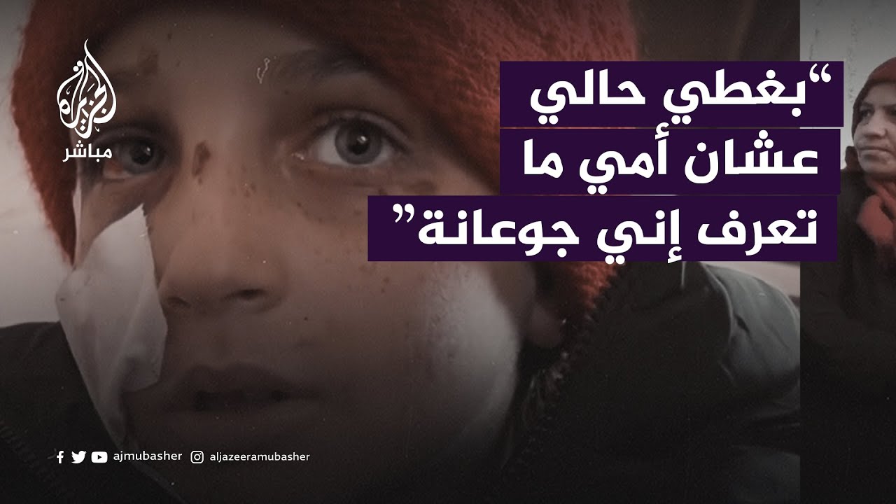 طفلة مصابة تلخص مأساة أطفال غزة