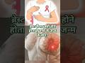 breast Cancer after baby delivery #shorts #shortsfeed #shortsviral #pregnancy #pregnancytips #baby