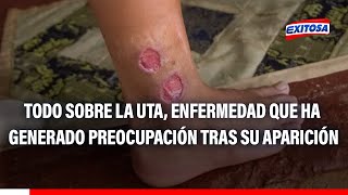 🔴🔵Leishmaniasis: ¿Qué es la uta, cómo se transmite y tiene cura?