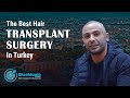 Hair transplant surgery turkey the process feedback  worldwide reviews  bluemagic clinic turkey