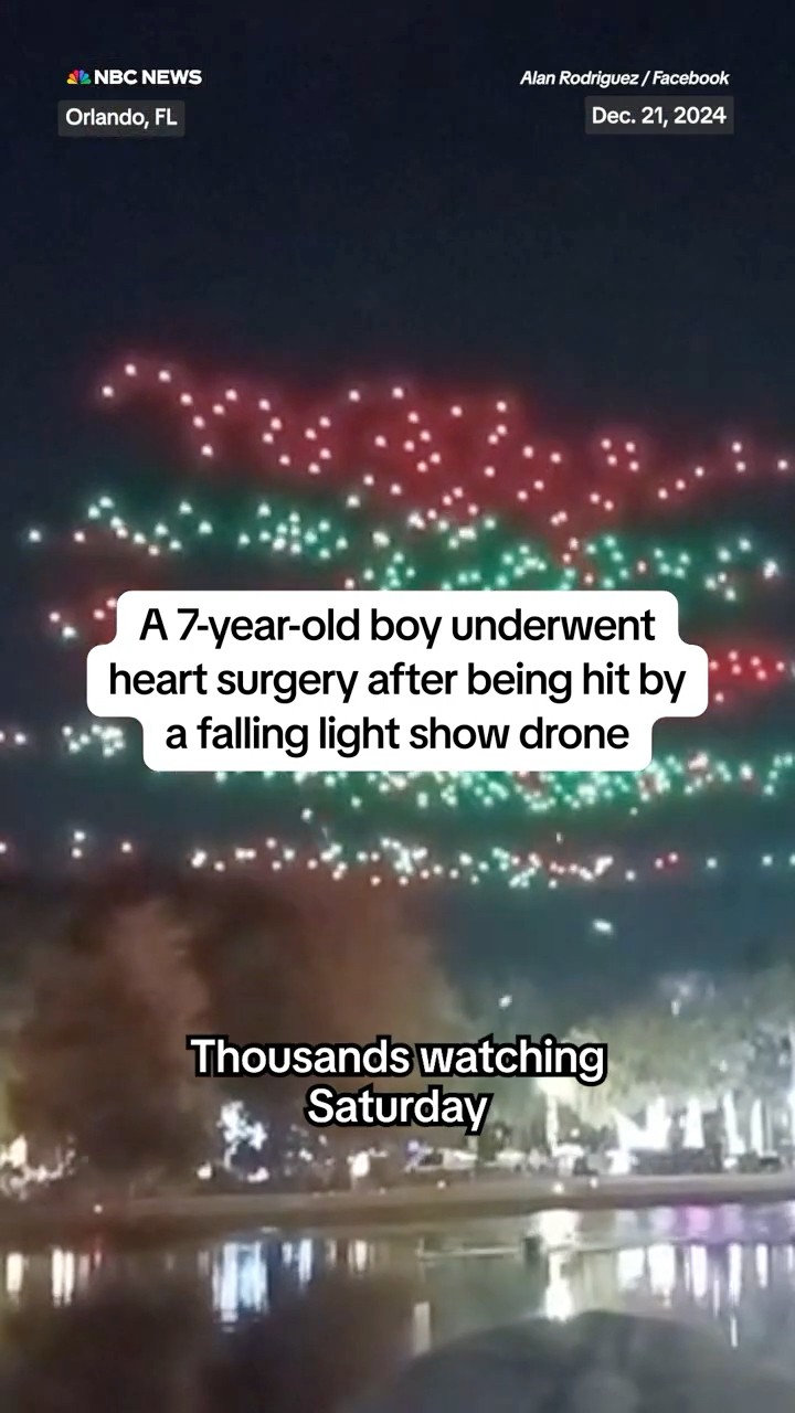 7-year-old boy underwent heart surgery after being hit by falling light show drone