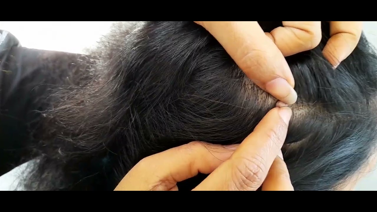 😊🌜 Soothing scalp checking video to sleep | white hair plucking video ❤️