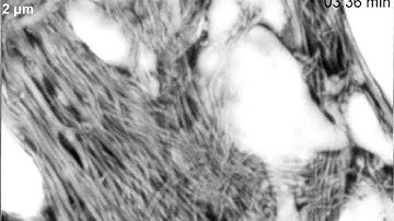 Microglia cell roaming through the brain