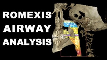Romexis Airway Analysis