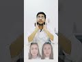 Botox for Wrinkles: How It Works and What to Expect | Dr. Ankit Sharma (Plastic &amp; Cosmetic Surgeon)